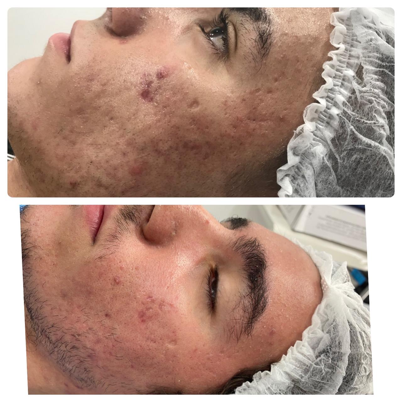 Resultado de Tratamento